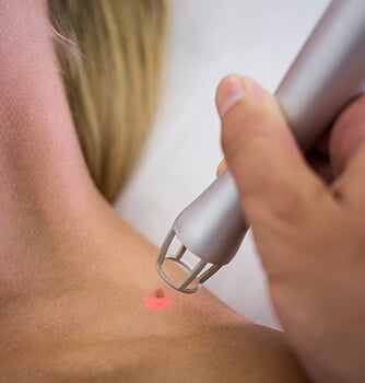 Wart-removal
