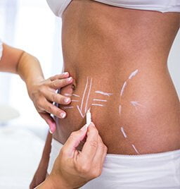 Liposuction-Post-Operative-Care