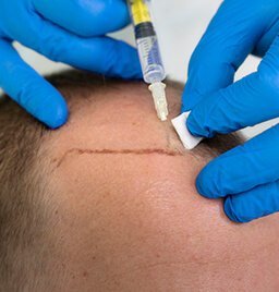 PRP-Customized-Treatment-Plans